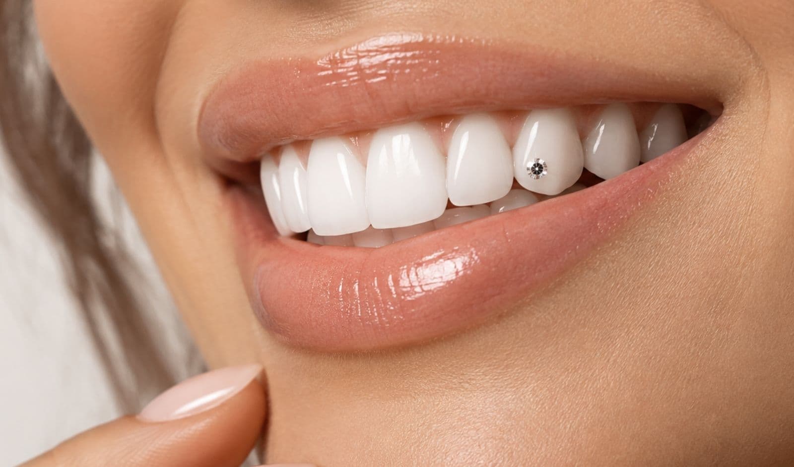 Teeth Whitening & Gems