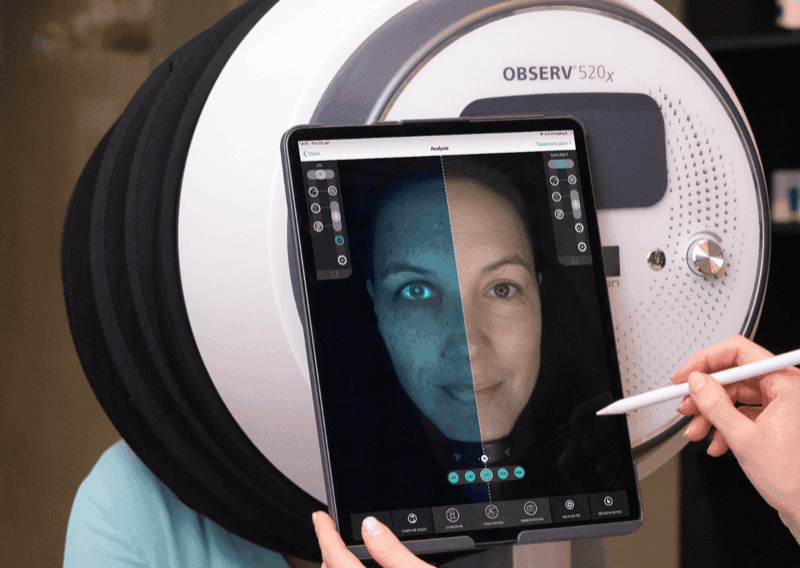 Observ Skin Analysis