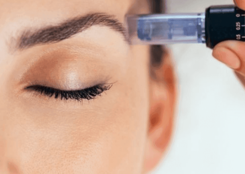 Skin Needling